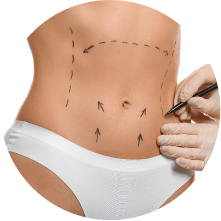 Пластика тела