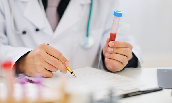 Исследование уровня бета-2-микроглобулина в крови