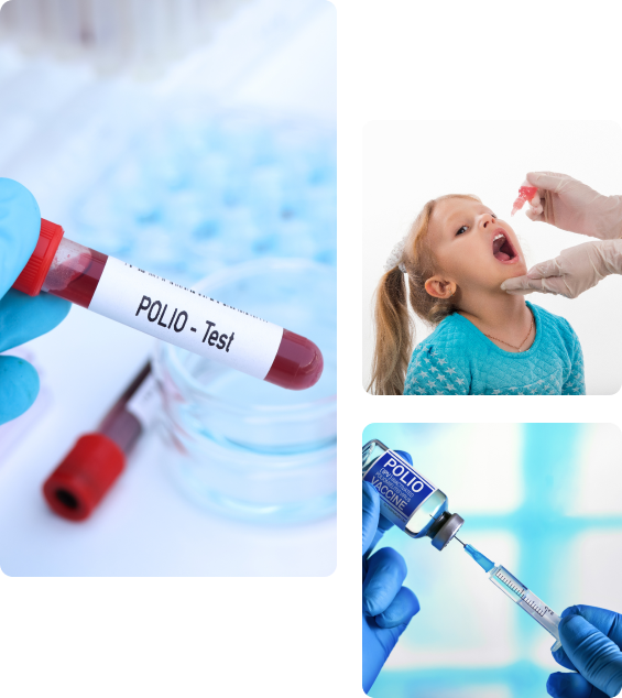 Осложнения после вакцинации детей от полиомиелита