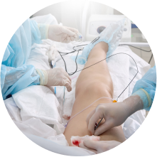 Радиочастотная абляция (РЧА) вен Радиочастотная абляция (РЧА) вен