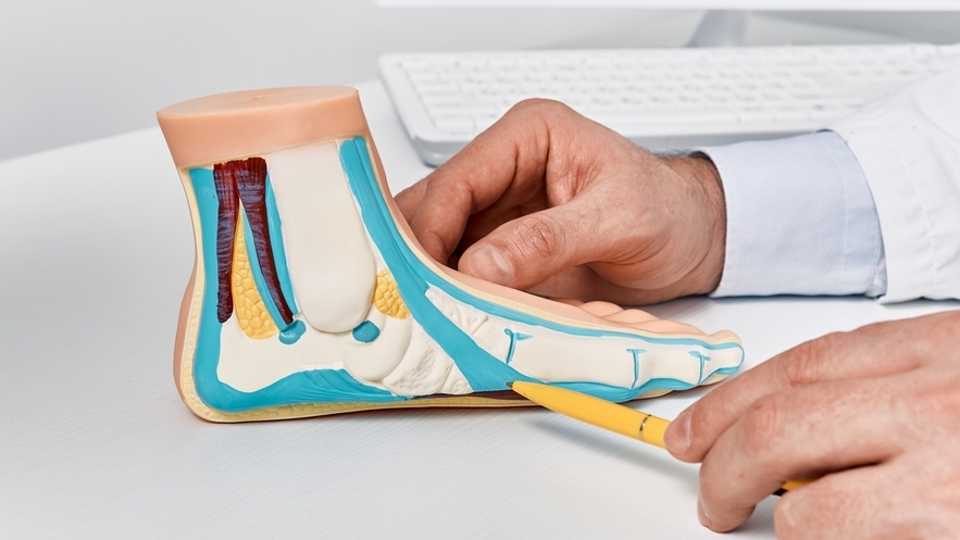 Показания к остеотомии пяточной кости