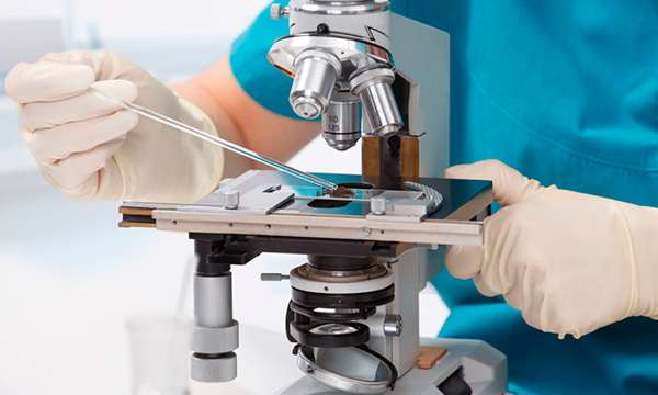 Общеклиническое исследование синовиальной жидкости