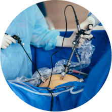 Нефропексия