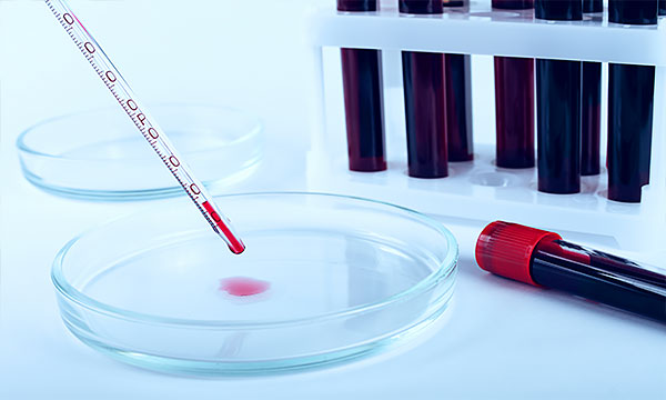 Анализ ретикулоцитов в крови