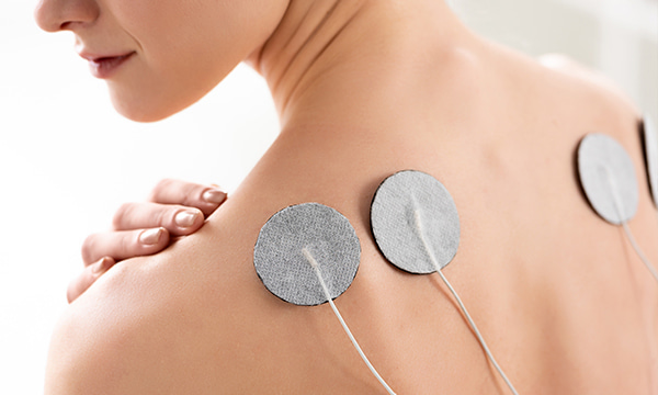 Электростимуляция (нейростимуляция)