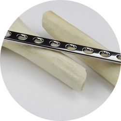 Остеосинтез плечевой кости Остеосинтез плечевой кости