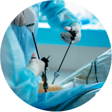 Удаление кисты почки