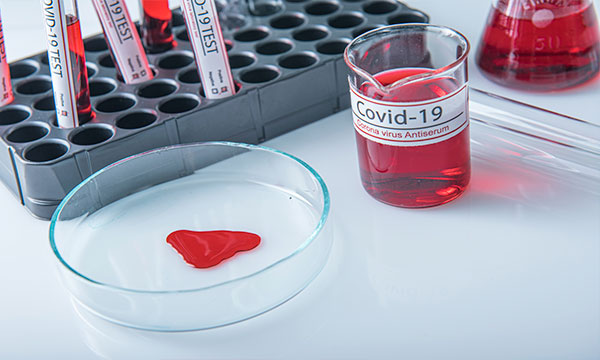 ПЦР тест на коронавирус с выявлением британского, южноафриканского/бразильского штаммов коронавируса SARS-CoV-2