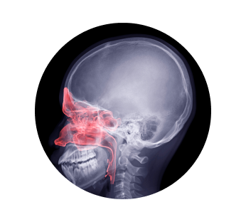 Рентген пазух носа