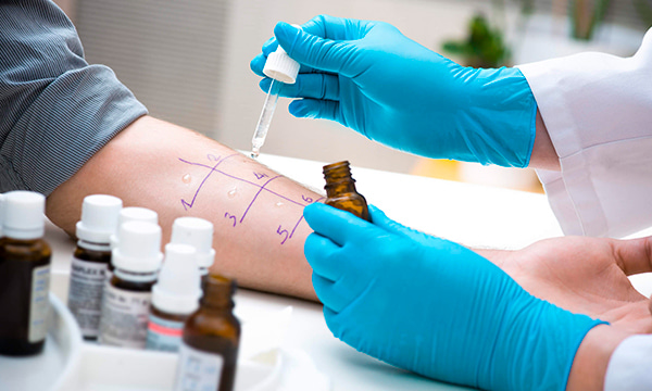 Антитела IgE к ингаляционной панели аллергенов IP6:G6/тимофеевка, M2/cladosporium herbarum,M6/alternaria tenuis, T3/береза, W6/полынь обыкновенная/Inhalant Panel 6 (g6, m2, m6, t3, w6) Антитела IgE к ингаляционной панели аллергенов IP6:G6/тимофеевка, M2/cladosporium herbarum,M6/alternaria tenuis, T3/береза, W6/полынь обыкновенная/Inhalant Panel 6 (g6, m2, m6, t3, w6)