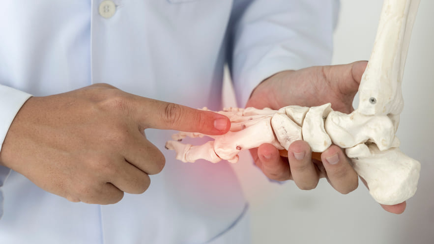 Показания к операции SCARF-остеотомии Показания к операция скарф