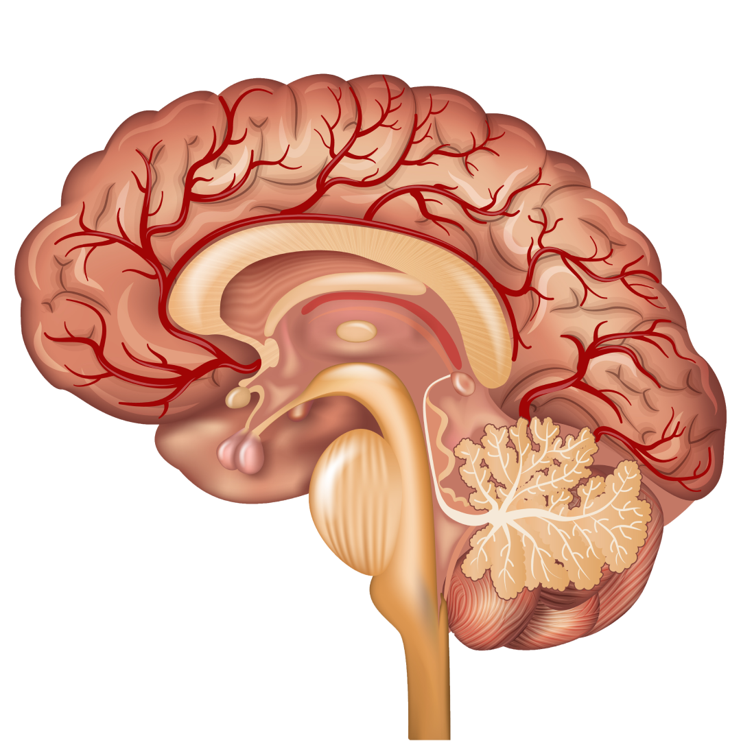 МРТ ангиография сосудов головного мозга