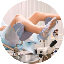 Надвлагалищная ампутация матки