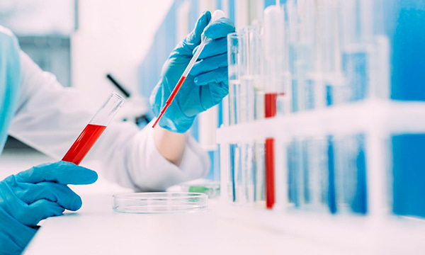 Коагулограмма (ПТИ+МНО+АЧТВ+ТВ+фибриноген) Коагулограмма (ПТИ+МНО+АЧТВ+ТВ+фибриноген)