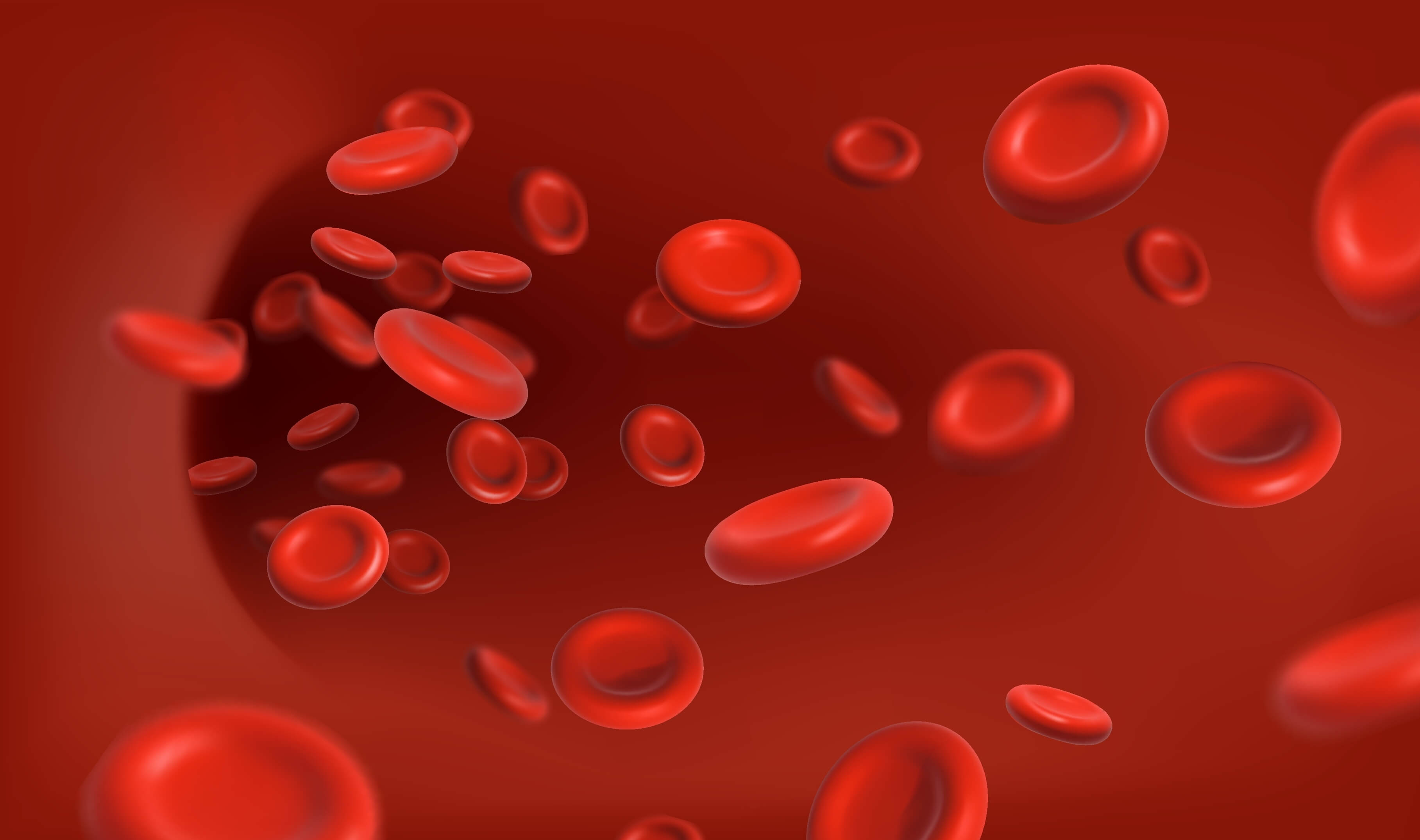 Анемия Анемия