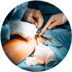 Остеосинтез голени