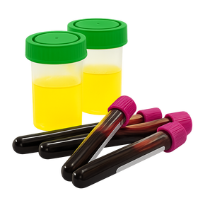 Виды исследований на дому