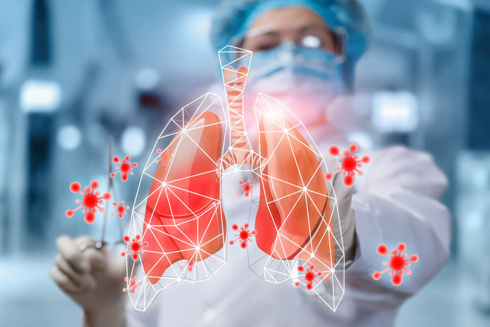 Аллергический альвеолит