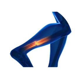 МРТ мягких тканей голени