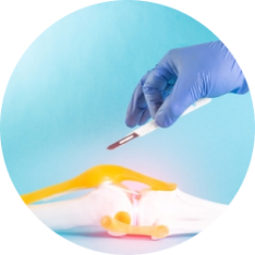 Эндопротезирование суставов Эндопротезирование суставов