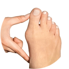 Шевронная остеотомия Шевронная остеотомия