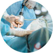 Удаление камней мочевого пузыря