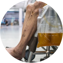 Установка и замена цистостомы (эпицистостомия)