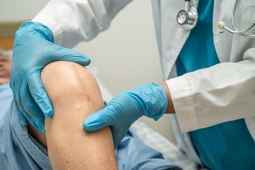 Показания к хондропластике коленного сустава