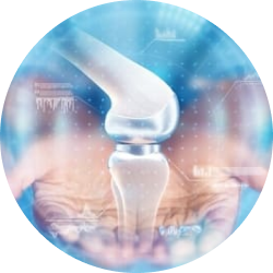 Хондропластика коленного сустава