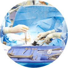 Удаление остроконечных кондилом