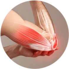 Пластика сухожилий Пластика сухожилий