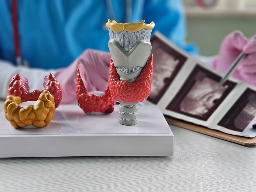 Микседема Микседема