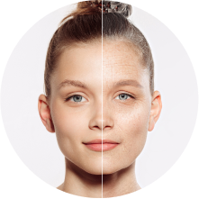 Липосакция лица