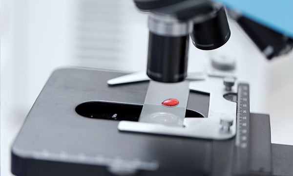 Анализ крови на ЛДГ