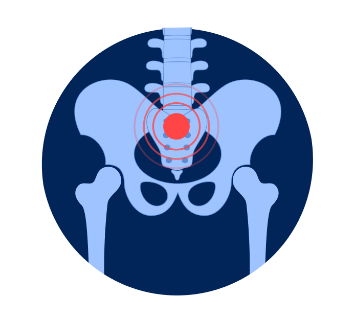 МРТ копчика МРТ копчика