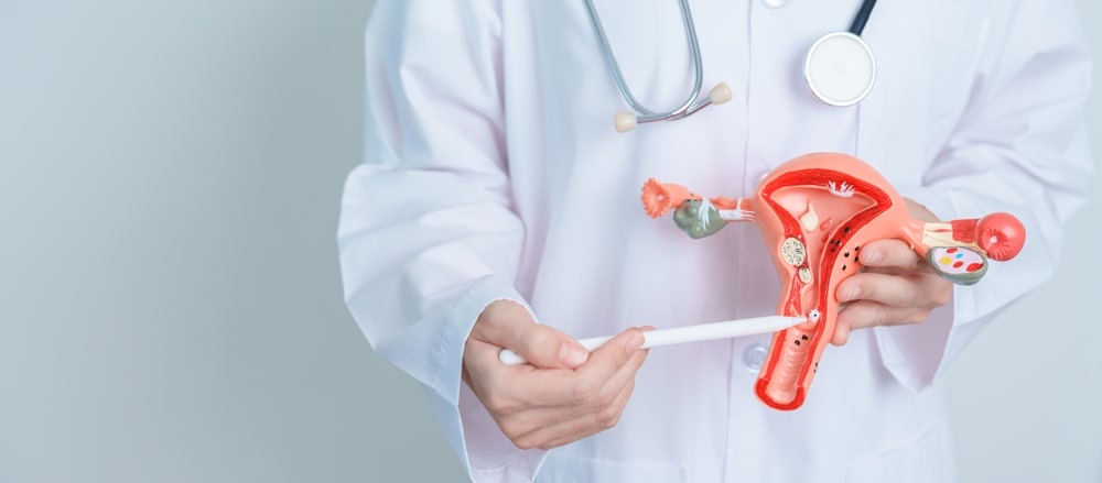 Фибромиома матки