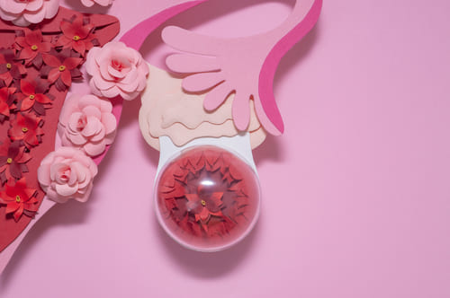 Киста яичника