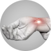 Туннельный синдром Туннельный синдром