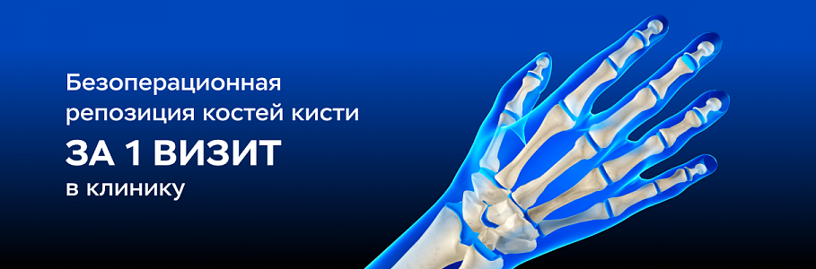 Репозиция костей кисти без операции за 1 прием