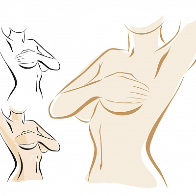 Профилактика мастопатии или как сохранить грудь здоровой и красивой