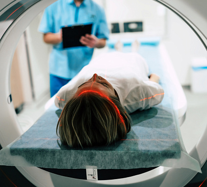 МСКТ сосудов головного мозга