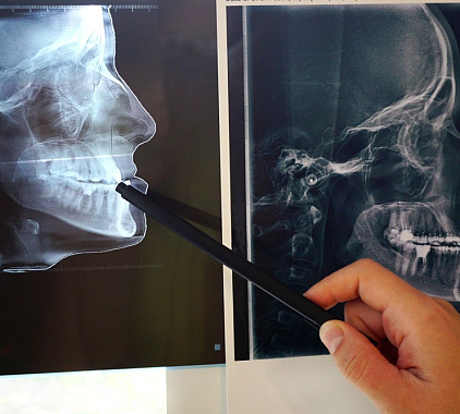 КТ челюсти КТ челюсти