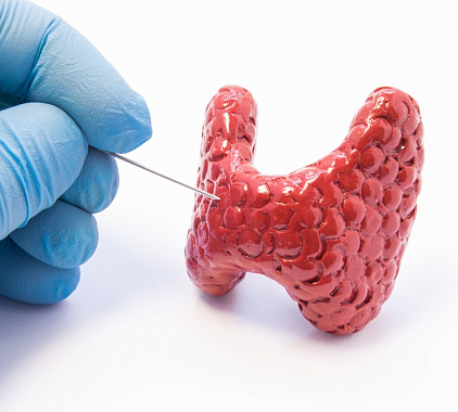 Пункция щитовидной железы Пункция щитовидной железы