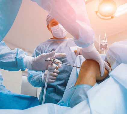 Артроскопия коленного сустава