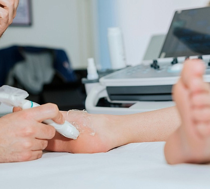 УЗИ стопы УЗИ стопы