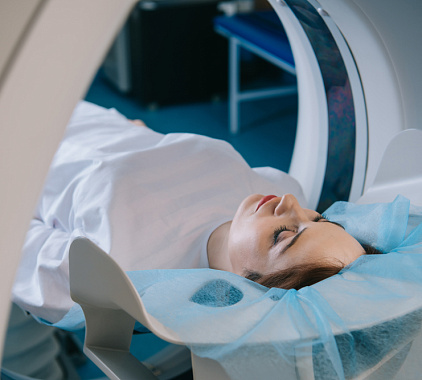 КТ сосудов головного мозга