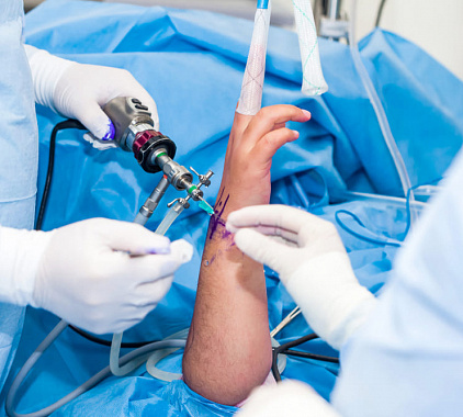 Артроскопия лучезапястного сустава