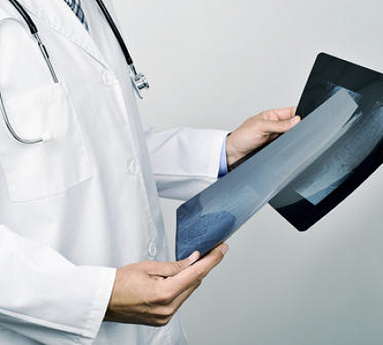 Рентген копчика