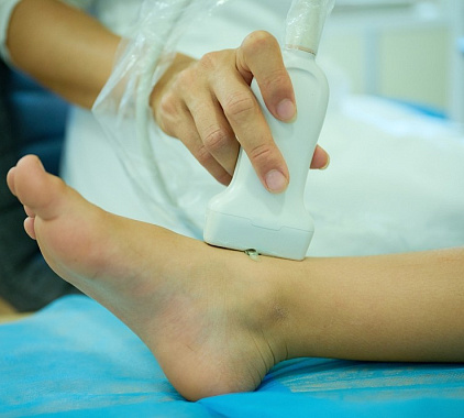 УЗИ стопы УЗИ стопы