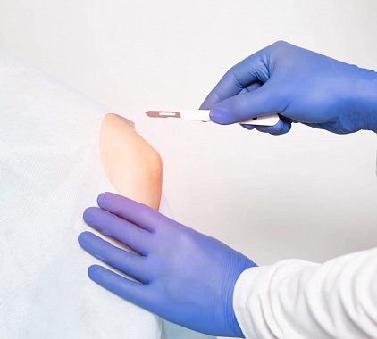 Артроскопия локтевого сустава